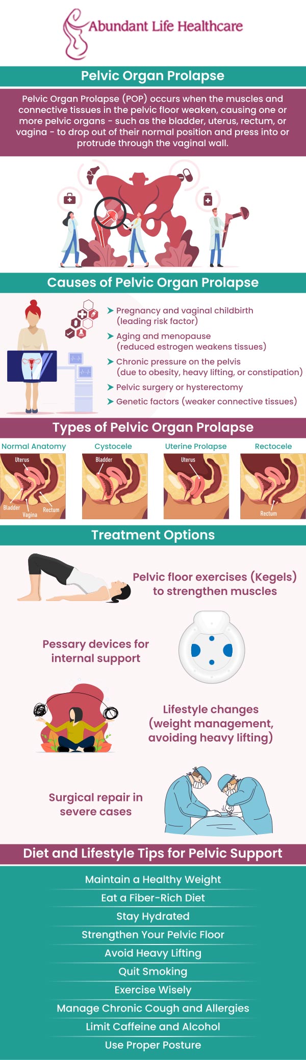 Pelvic Organ Prolapse (POP) is a condition in which one or more pelvic organs fall from their actual location and bulge into the vagina as a result of weakening or tearing of the pelvic floor muscles and connective tissue. It could be the uterus, colon, bladder, or top of the vagina. Prolapses are not considered a life-threatening concern, but they can be painful and uncomfortable. Women of all ages can receive diagnosis and treatment for pelvic health issues from our board-certified OB/GYN, Dr. Marc Jean-Gilles, DO, FACOG at Abundant Life Healthcare. For more information, contact us today or book an appointment online. We are conveniently located at 601A Professional Drive, Suite 370, Lawrenceville, GA 30046.