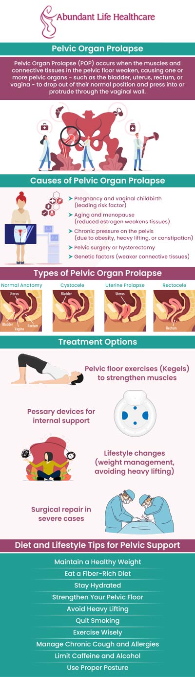 Pelvic Organ Prolapse (POP) is a condition in which one or more pelvic organs fall from their actual location and bulge into the vagina as a result of weakening or tearing of the pelvic floor muscles and connective tissue. It could be the uterus, colon, bladder, or top of the vagina. Prolapses are not considered a life-threatening concern, but they can be painful and uncomfortable. Women of all ages can receive diagnosis and treatment for pelvic health issues from our board-certified OB/GYN, Dr. Marc Jean-Gilles, DO, FACOG at Abundant Life Healthcare. For more information, contact us today or book an appointment online. We are conveniently located at 601A Professional Drive, Suite 370, Lawrenceville, GA 30046.