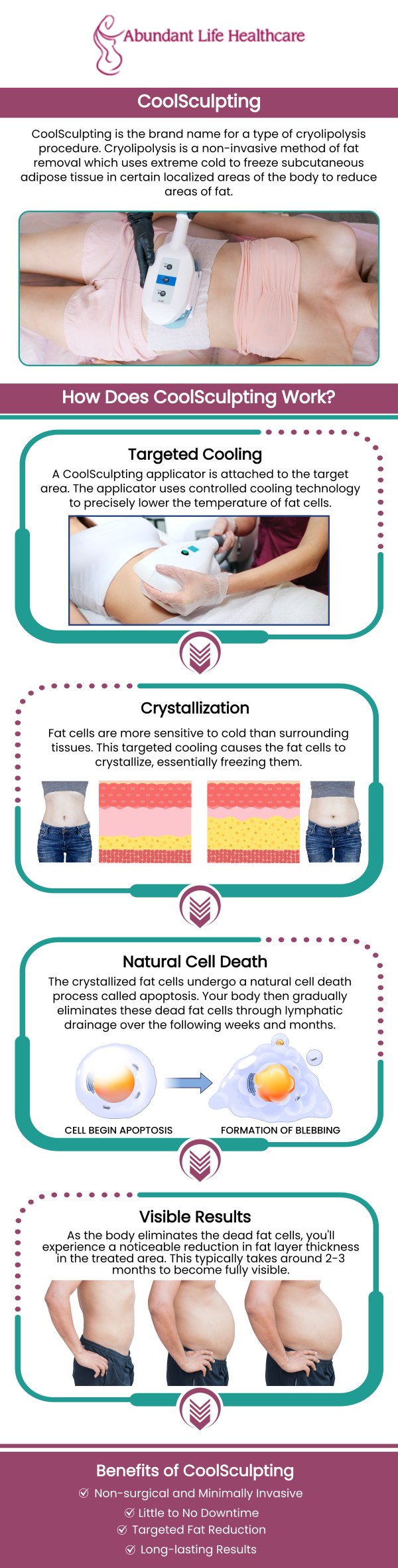 CoolSculpting is a non-invasive treatment that targets stubborn fat in areas such as the abdomen, flanks, thighs, double chin, back, arms, and beneath the buttocks. It helps contour and reshape areas unresponsive to diet and exercise. Consulting with our dedicated professionals is crucial to determine which areas are best suited for treatment, ensuring optimal results. For more information, contact us today or book an appointment online. We are conveniently located at 601A Professional Drive, Suite 370, Lawrenceville, GA 30046. CoolSculpting is a non-invasive treatment that targets stubborn fat in areas such as the abdomen, flanks, thighs, double chin, back, arms, and beneath the buttocks. It helps contour and reshape areas unresponsive to diet and exercise. Consulting with our dedicated professionals is crucial to determine which areas are best suited for treatment, ensuring optimal results. For more information, contact us today or book an appointment online. We are conveniently located at 601A Professional Drive, Suite 370, Lawrenceville, GA 30046.